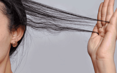Why Men and Women Experience Hair Loss and How to Address It